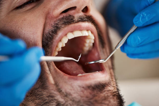 Best Weekend Emergency Dental Services in Zeigler, IL