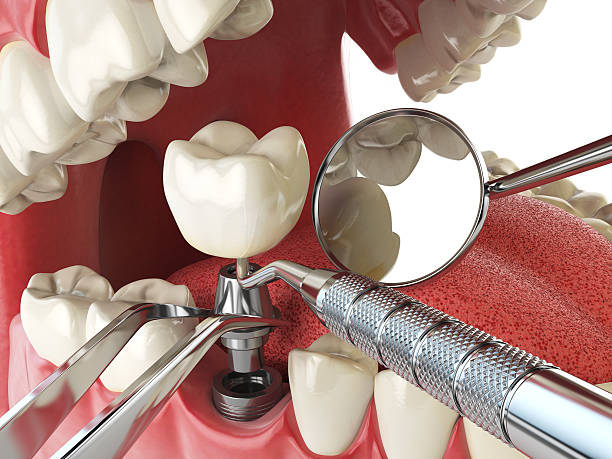 Best 24-Hour Emergency Dental Care in Zeigler, IL